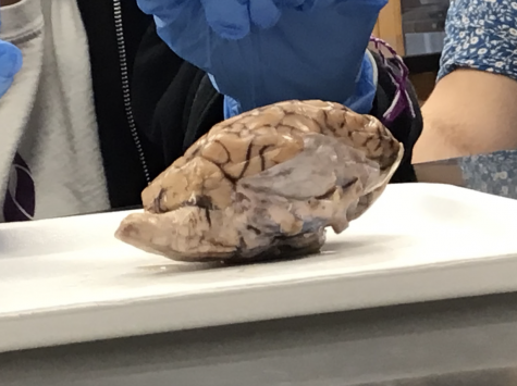 7th Grade Medical Detectives Dissect Brain